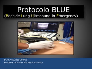 Protocolo BLUE
(Bedside Lung Ultrasound in Emergency)
DENIS VASQUEZ QUIROS
Residente de Primer Año Medicina Critica
 