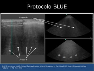 Blue protocolo | PPTX