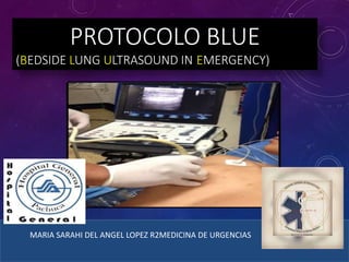PROTOCOLO BLUE
(BEDSIDE LUNG ULTRASOUND IN EMERGENCY)
MARIA SARAHI DEL ANGEL LOPEZ R2MEDICINA DE URGENCIAS
 