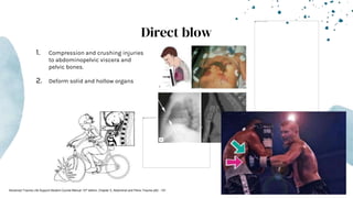 Direct blow
1. Compression and crushing injuries
to abdominopelvic viscera and
pelvic bones.
2. Deform solid and hollow organs
Advanced Trauma Life Support Student Course Manual 10th edition. Chapter 5, Abdominal and Pelvic Trauma p82 - 101
 