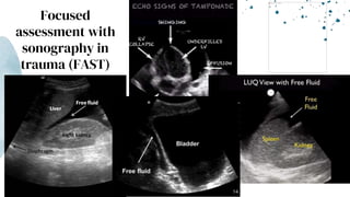 Focused
assessment with
sonography in
trauma (FAST)
 