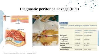 Diagnostic peritoneal lavage (DPL)
-Schwartz’s Principles of Surgery Eleventh Edition: chapter 7- Trauma, page 183- 249
 