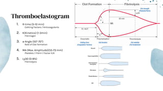 Thromboelastogram
1. R-time (5-10 min)
Coltting Factars / Anticoagulants
2. K(Kinetics) (1-3min)
Fibrinogen
3. α-Angle (50°-70°)
Rate of Clot formation
4. MA (Max. Amplitude)(55-73 mm)
Platelets / Fibrin / Factar II,III
5. Ly30 (0-8%)
Fibrinolysis
 