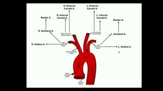 Traumatic Aortic Disruption CXR
Findings
1. Wide mediastinum
2. Abnormal aortic contour
3. Loss of aortopulmonary window
4...