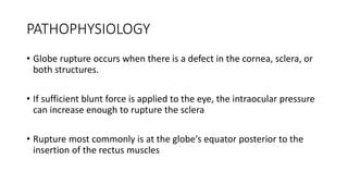 Globe Rupture Memory Note BLUNT EYE TRAUMA.pptx