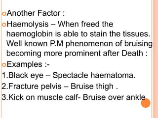 Another Factor : Haemolysis – When freed the haemoglobin is able to stain the tissues. Well known P.M phenomenon of bruising becoming more prominent after Death : Examples :-1.Black eye – Spectacle haematoma.2.Fracture pelvis – Bruise thigh .3.Kick on muscle calf- Bruise over ankle 