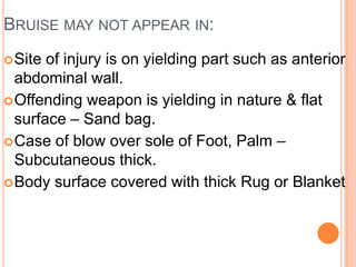 Bruise may not appear in:Site of injury is on yielding part such as anterior abdominal wall. Offending weapon is yielding in nature & flat surface – Sand bag.Case of blow over sole of Foot, Palm – Subcutaneous thick.Body surface covered with thick Rug or Blanket 