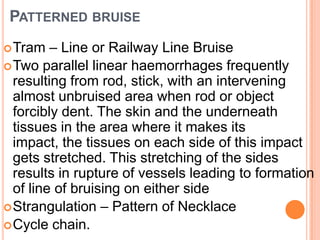Patterned bruiseTram – Line or Railway Line Bruise Two parallel linear haemorrhages frequently resulting from rod, stick, with an intervening almost unbruised area when rod or object forcibly dent. The skin and the underneath tissues in the area where it makes its impact, the tissues on each side of this impact gets stretched. This stretching of the sides results in rupture of vessels leading to formation of line of bruising on either side Strangulation – Pattern of Necklace Cycle chain.