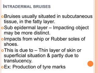 Intradermal bruisesBruises usually situated in subcutaneous tissue, in the fatty layer. Sub epidermal layer – Impacting object may be more distinct. Impacts from whip or Rubber soles of shoes.This is due to – Thin layer of skin or superficial situation & partly due to translucency. Ex: Production of tyre marks