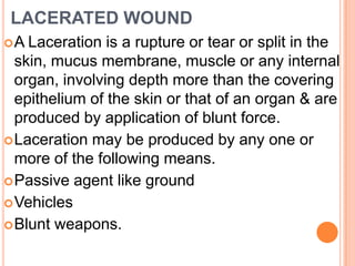 LACERATED WOUND A Laceration is a rupture or tear or split in the skin, mucus membrane, muscle or any internal organ, involving depth more than the covering epithelium of the skin or that of an organ & are produced by application of blunt force.Laceration may be produced by any one or more of the following means.Passive agent like groundVehiclesBlunt weapons.