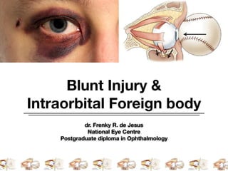Blunt Injury &
Intraorbital Foreign body
dr. Frenky R. de Jesus
National Eye Centre
Postgraduate diploma in Ophthalmology
 