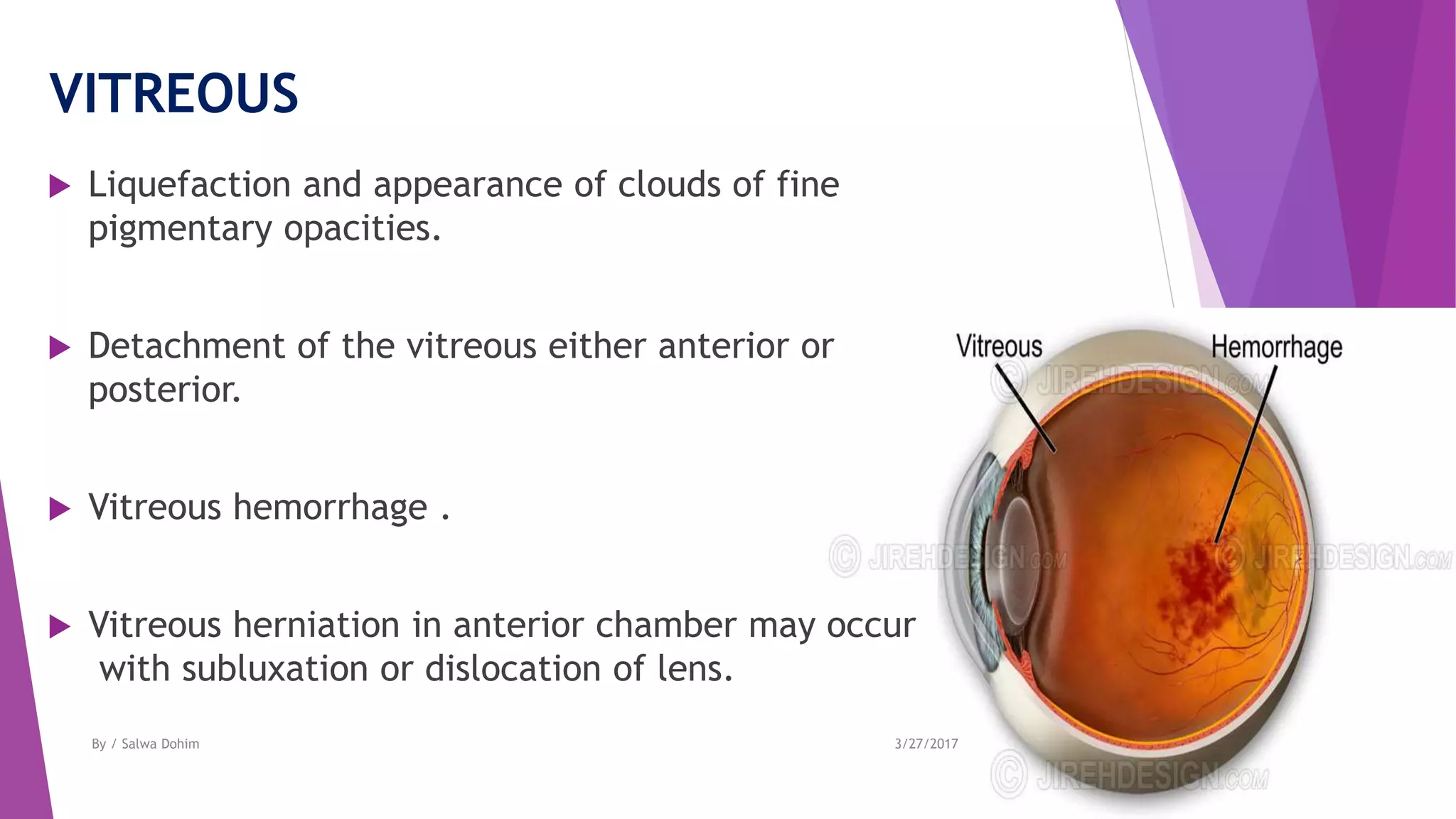 VITREOUS
 Liquefaction and appearance of clouds of fine
pigmentary opacities.
 Detachment of the vitreous either anterior or
posterior.
 Vitreous hemorrhage .
 Vitreous herniation in anterior chamber may occur
with subluxation or dislocation of lens.
3/27/2017By / Salwa Dohim
 