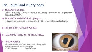 Blunt trauma of the eye | PPTX
