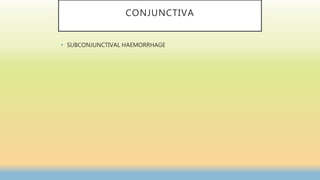 CONJUNCTIVA
• SUBCONJUNCTIVAL HAEMORRHAGE
 