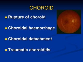 BLUNT TRAUMA.powerpoint presentation ppt | PPT