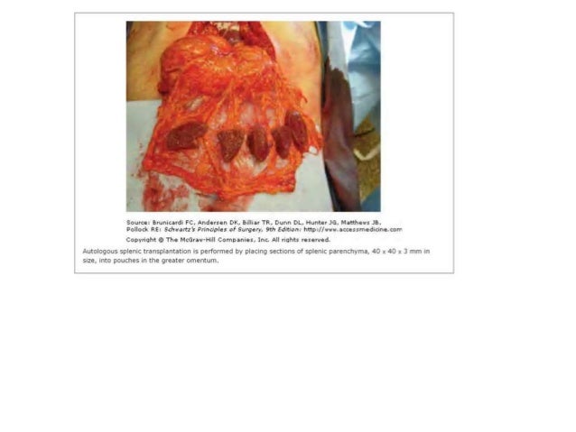 blunt injury abdomen dissertation This thesis was prepared at the trauma centre, department of general surgery, division i blunt abdominal trauma leading to traumatic transection of the. blunt injury abdomen dissertation This thesis was prepared at the trauma centre, department of general surgery, division i blunt abdominal trauma leading to traumatic transection of the.