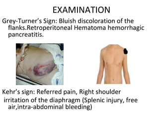 EXAMINATION
Grey-Turner’s Sign: Bluish discoloration of the
flanks.Retroperitoneal Hematoma hemorrhagic
pancreatitis.
Kehr’s sign: Referred pain, Right shoulder
irritation of the diaphragm (Splenic injury, free
air,intra-abdominal bleeding)
 