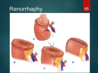 Renorrhaphy 66
 