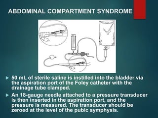 ABDOMINAL COMPARTMENT SYNDROME
 50 mL of sterile saline is instilled into the bladder via
the aspiration port of the Foley catheter with the
drainage tube clamped.
 An 18-gauge needle attached to a pressure transducer
is then inserted in the aspiration port, and the
pressure is measured. The transducer should be
zeroed at the level of the pubic symphysis.
 