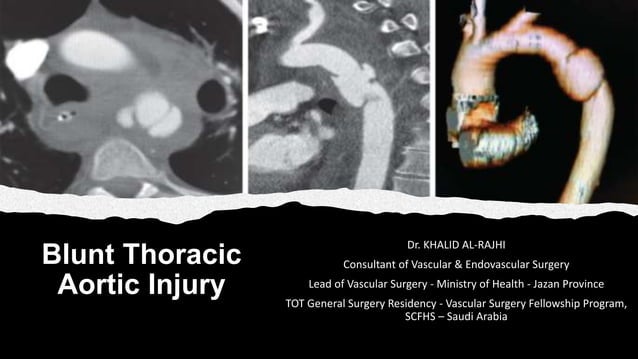 Blunt Thoracic Aortic Injury BTAI | PPSX | First Aid | Injuries