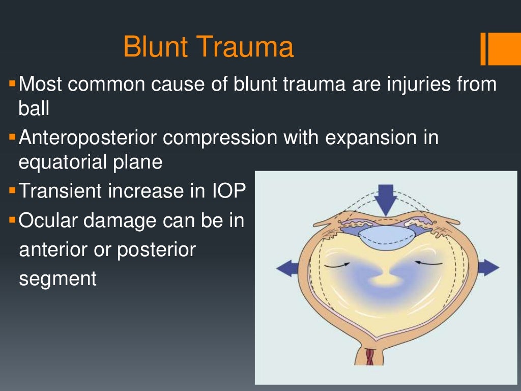 Blunt trauma & blow out fracture