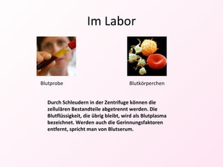 Im Labor Durch Schleudern in der Zentrifuge können die zellulären Bestandteile abgetrennt werden. Die Blutflüssigkeit, die übrig bleibt, wird als Blutplasma bezeichnet. Werden auch die Gerinnungsfaktoren entfernt, spricht man von Blutserum. Blutkörperchen Blutprobe 
