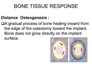 BONE TISSUE RESPONSE
Osborn and Newesley (1980) : Proposed 2 different phenomena
Distance Osteogenesis :
A gradual process of bone healing inward from
the edge of the osteotomy toward the implant.
Bone does not grow directly on the implant
surface.
 