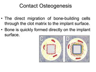 Contact Osteogenesis
• The direct migration of bone-building cells
through the clot matrix to the implant surface.
• Bone is quickly formed directly on the implant
surface.
 