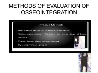 METHODS OF EVALUATION OF
OSSEOINTEGRATION
 