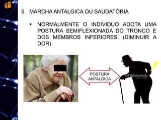 5. MARCHA ANTALGICA OU SAUDATÓRIA
 NORMALMENTE O INDIVIDUO ADOTA UMA
POSTURA SEMIFLEXIONADA DO TRONCO E
DOS MEMBROS INFERIORES. (DIMINUIR A
DOR)
POSTURA
ANTALGICA
 