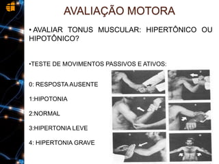 • AVALIAR TONUS MUSCULAR: HIPERTÔNICO OU
HIPOTÔNICO?
•TESTE DE MOVIMENTOS PASSIVOS E ATIVOS:
0: RESPOSTA AUSENTE
1:HIPOTONIA
2:NORMAL
3:HIPERTONIA LEVE
4: HIPERTONIA GRAVE
AVALIAÇÃO MOTORA
 