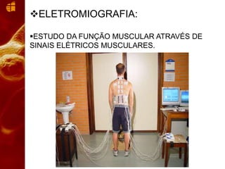 ELETROMIOGRAFIA:
ESTUDO DA FUNÇÃO MUSCULAR ATRAVÉS DE
SINAIS ELÉTRICOS MUSCULARES.
 