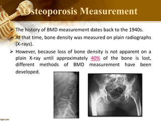  The history of BMD measurement dates back to the 1940s.
 At that time, bone density was measured on plain radiographs
(X-rays).
 However, because loss of bone density is not apparent on a
plain X-ray until approximately 40% of the bone is lost,
different methods of BMD measurement have been
developed.
Osteoporosis Measurement
 