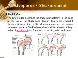  Singh Index
• The Singh index describes the trabecular patterns in the bone
at the top of the thigh bone (femur). X-rays are graded 1
through 6 according to the disappearance of the normal
trabecular pattern. Studies have shown a link between a Singh
index of less than 3 and fractures of the hip, wrist, and spine.
Osteoporosis Measurement
 