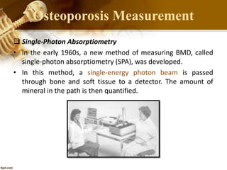  Single-Photon Absorptiometry
• In the early 1960s, a new method of measuring BMD, called
single-photon absorptiometry (SPA), was developed.
• In this method, a single-energy photon beam is passed
through bone and soft tissue to a detector. The amount of
mineral in the path is then quantified.
Osteoporosis Measurement
 