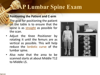  Positioning the Patient and C-arm
• The goal for positioning the patient
on the table is to ensure that the
spine is as straight as possible for
the scan.
• Adjust the Knee Positioner by
rotating it until the femurs are as
vertical as possible. This will help
reduce the lordotic curve of the
lumbar spine.
• Also note that the area to be
scanned starts at about Middle T12
to Middle L5.
AP Lumbar Spine Exam
 