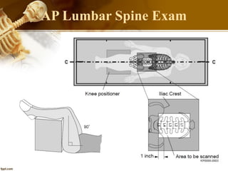 AP Lumbar Spine Exam
 