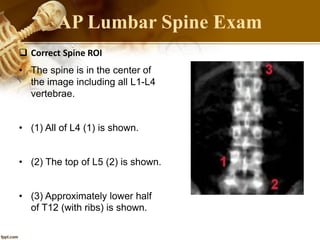 41
 Correct Spine ROI
• The spine is in the center of
the image including all L1-L4
vertebrae.
• (1) All of L4 (1) is shown.
• (2) The top of L5 (2) is shown.
• (3) Approximately lower half
of T12 (with ribs) is shown.
AP Lumbar Spine Exam
 