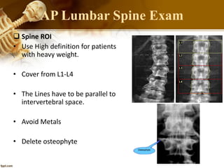  Spine ROI
• Use High definition for patients
with heavy weight.
• Cover from L1-L4
• The Lines have to be parallel to
intervertebral space.
• Avoid Metals
• Delete osteophyte
AP Lumbar Spine Exam
 