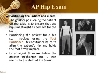  Positioning the Patient and C-arm
• The goal for positioning the patient
on the table is to ensure that the
hip is as straight as possible for the
scan.
• Positioning the patient for a hip
scan involves using the Foot
Positioner. This positioner helps to
align the patient’s hip and holds
the foot firmly in place.
• Laser adjust 3 inches below the
greater trochanter and 1 inch
medial to the shaft of the femur.
AP Hip Exam
 
