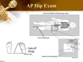 AP Hip Exam
 