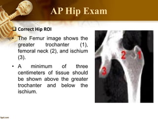 46
 Correct Hip ROI
• The Femur image shows the
greater trochanter (1),
femoral neck (2), and ischium
(3).
• A minimum of three
centimeters of tissue should
be shown above the greater
trochanter and below the
ischium.
AP Hip Exam
 