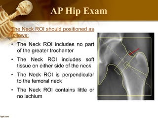 The Neck ROI should positioned as
follows:
• The Neck ROI includes no part
of the greater trochanter
• The Neck ROI includes soft
tissue on either side of the neck
• The Neck ROI is perpendicular
to the femoral neck
• The Neck ROI contains little or
no ischium
AP Hip Exam
 