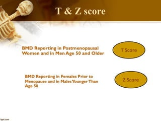 T & Z score
T Score
Z Score
 