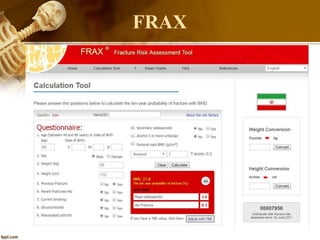 FRAX
 