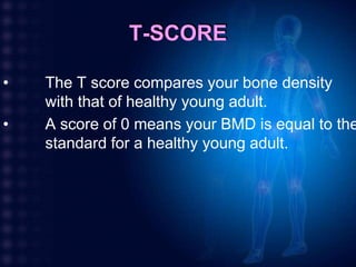 Normal T Score Bone Mineral Density | PPTX