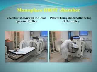 Monoplace HBOT chamber
Chamber shown with the Door
open and Trolley
Patient being slided with the top
of the trolley
 