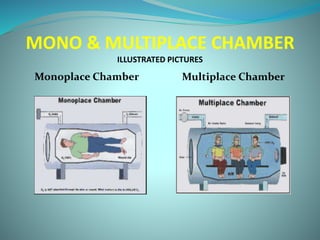 MONO & MULTIPLACE CHAMBER
ILLUSTRATED PICTURES
Monoplace Chamber Multiplace Chamber
 