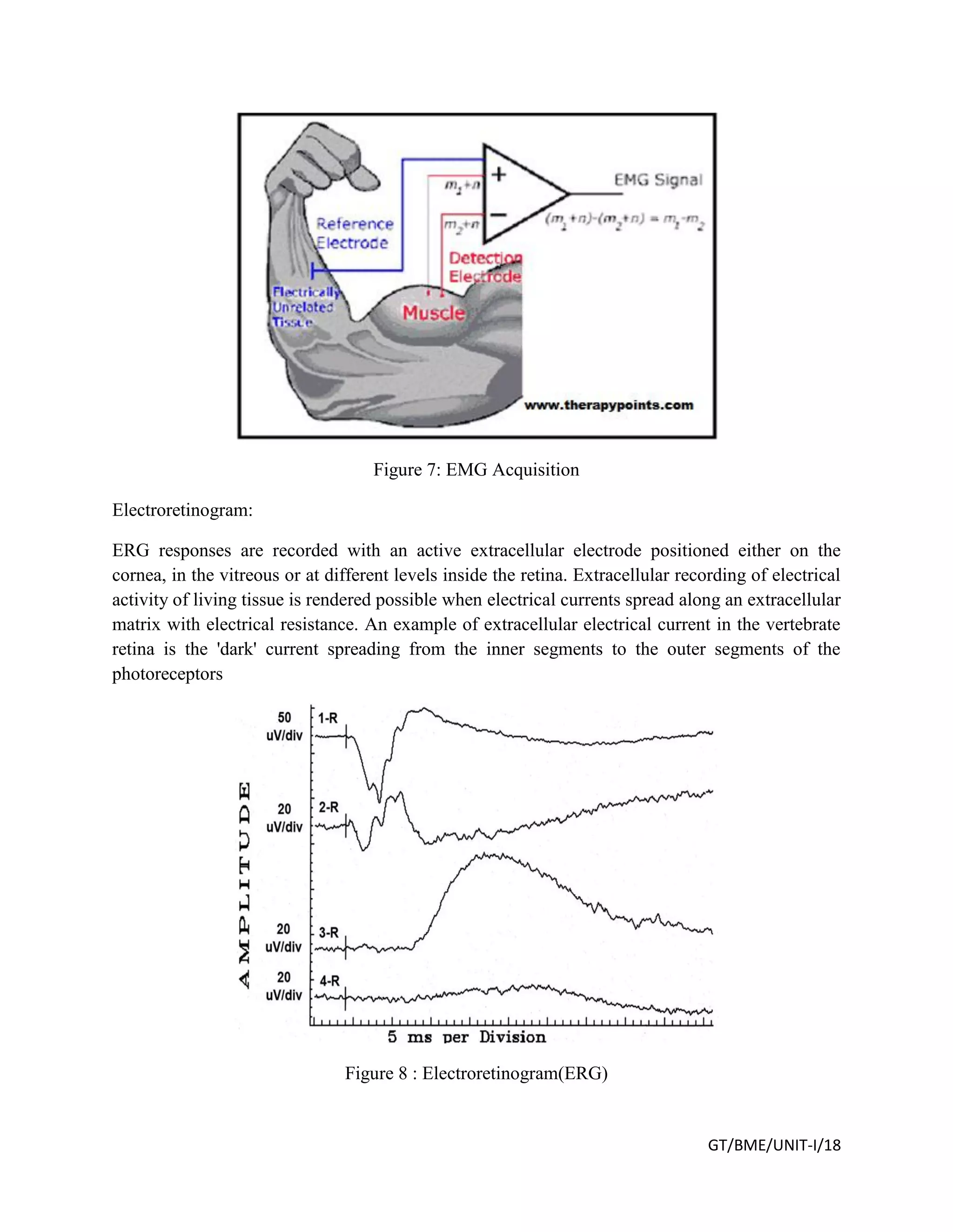 GT/BME/UNIT-I/18
Figure 7: EMG Acquisition
Electroretinogram:
ERG responses are recorded with an active extracellular electrode positioned either on the
cornea, in the vitreous or at different levels inside the retina. Extracellular recording of electrical
activity of living tissue is rendered possible when electrical currents spread along an extracellular
matrix with electrical resistance. An example of extracellular electrical current in the vertebrate
retina is the 'dark' current spreading from the inner segments to the outer segments of the
photoreceptors
Figure 8 : Electroretinogram(ERG)
 