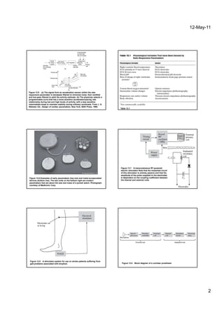 Biomedical InstrumentationUnipolar and bipolar implementations of both ...